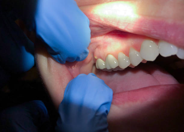Best Pediatric Emergency Dentist in Mill Valley, CA