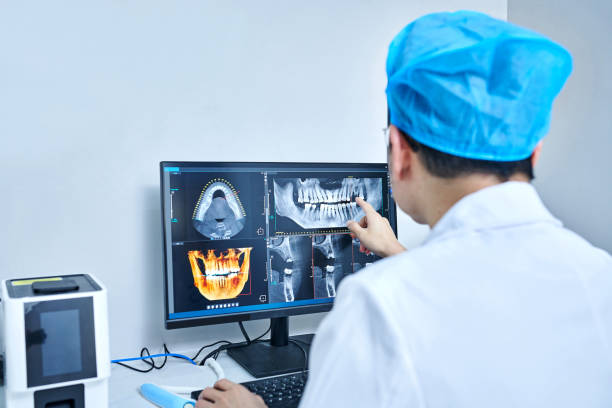 Best Emergency Root Canal Treatment in Mill Valley, CA