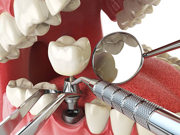 Best Emergency Dental Care for Trauma or Injury in Mill Valley, CA